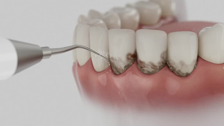 Reliable Dental Implants contractor in Florence, CO by Smile Center Dentistry
